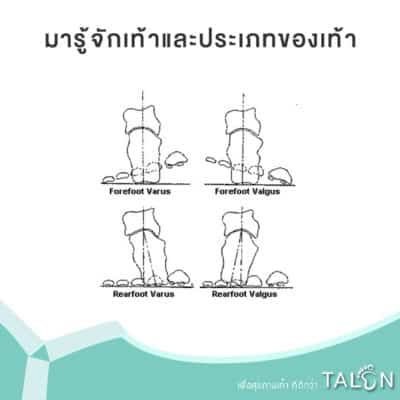 มารู้จักเท้าและประเภทของเท้า