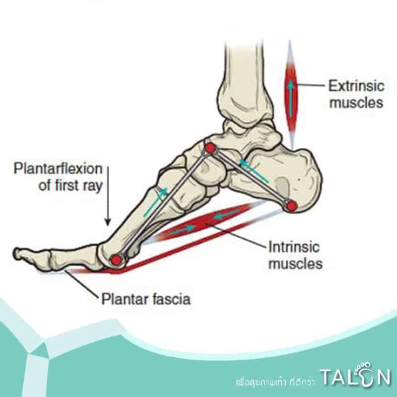 รองช้ำ ( plantar fasciitis)