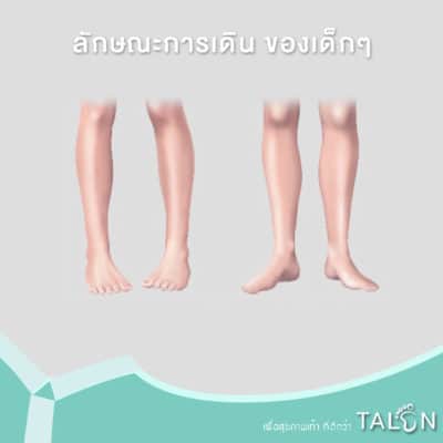 ลักษณะการเดิน-ของเด็กๆ