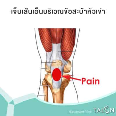 อาการที่เจ็บเส้นเอ็นบริเวณข้อสะบ้าหัวเข่า