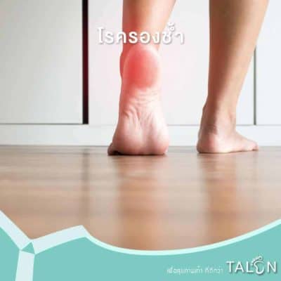 รู้จักโรครองช้ำ