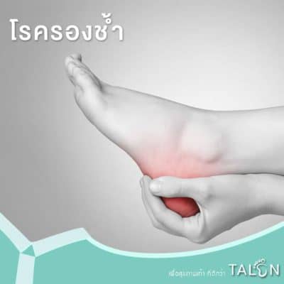 โรครองช้ำ