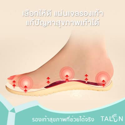 เลือกให้ดี แผ่นเจลรองเท้า แก้ปัญหาสุขภาพเท้าได้