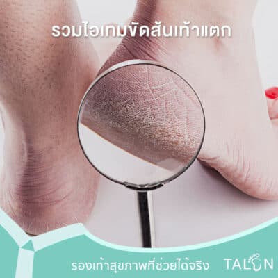 รวมไอเทมขัดส้นเท้าแตก