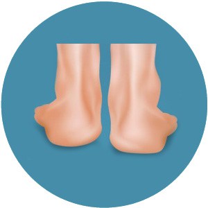 เท้าสั้นยาวไม่เท่ากัน