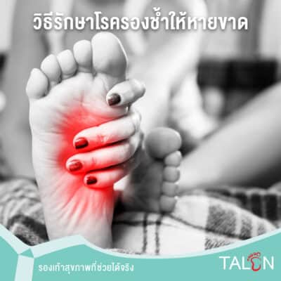 วิธีรักษาโรครองช้ำให้หายขาด