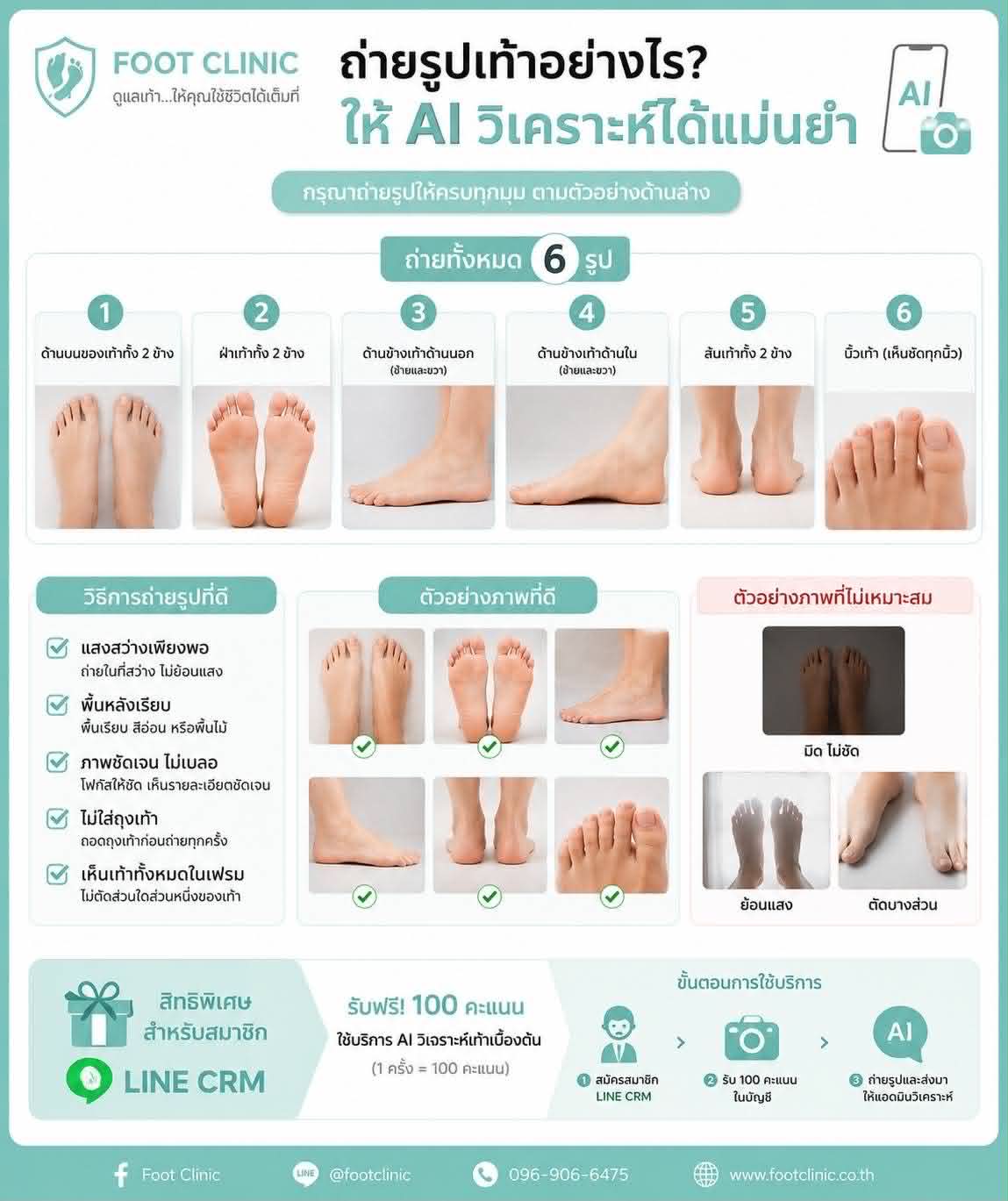 ถ่ายรูปเท้า วิเคราะห์ปัญหา