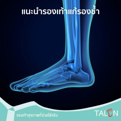 แนะนำรองเท้าแก้รองช้ำ