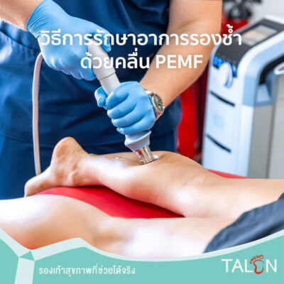วิธีการรักษาอาการรองช้ำ ด้วยคลื่น PEMF