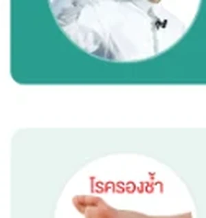โรครองช้ำ