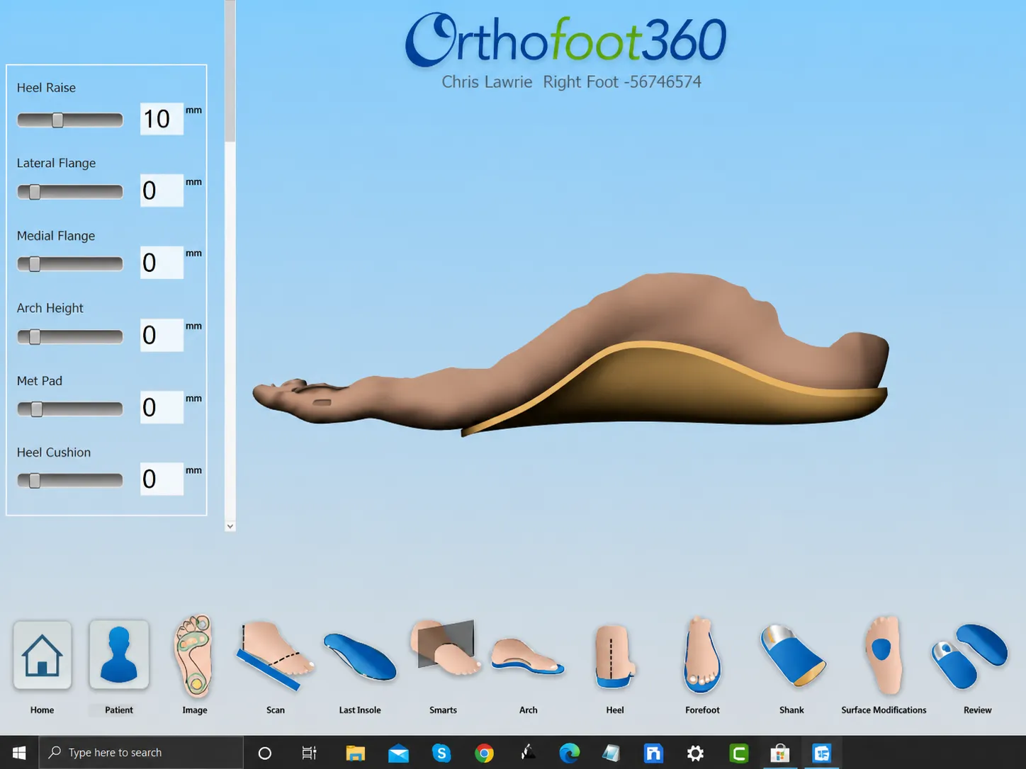 3D Printing Orthotic Insole